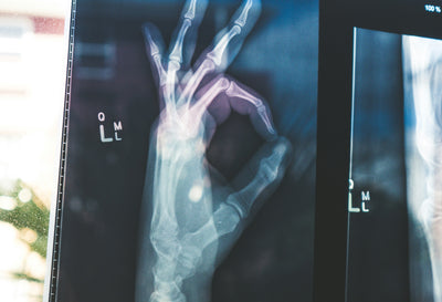 Menopause and Bone Health